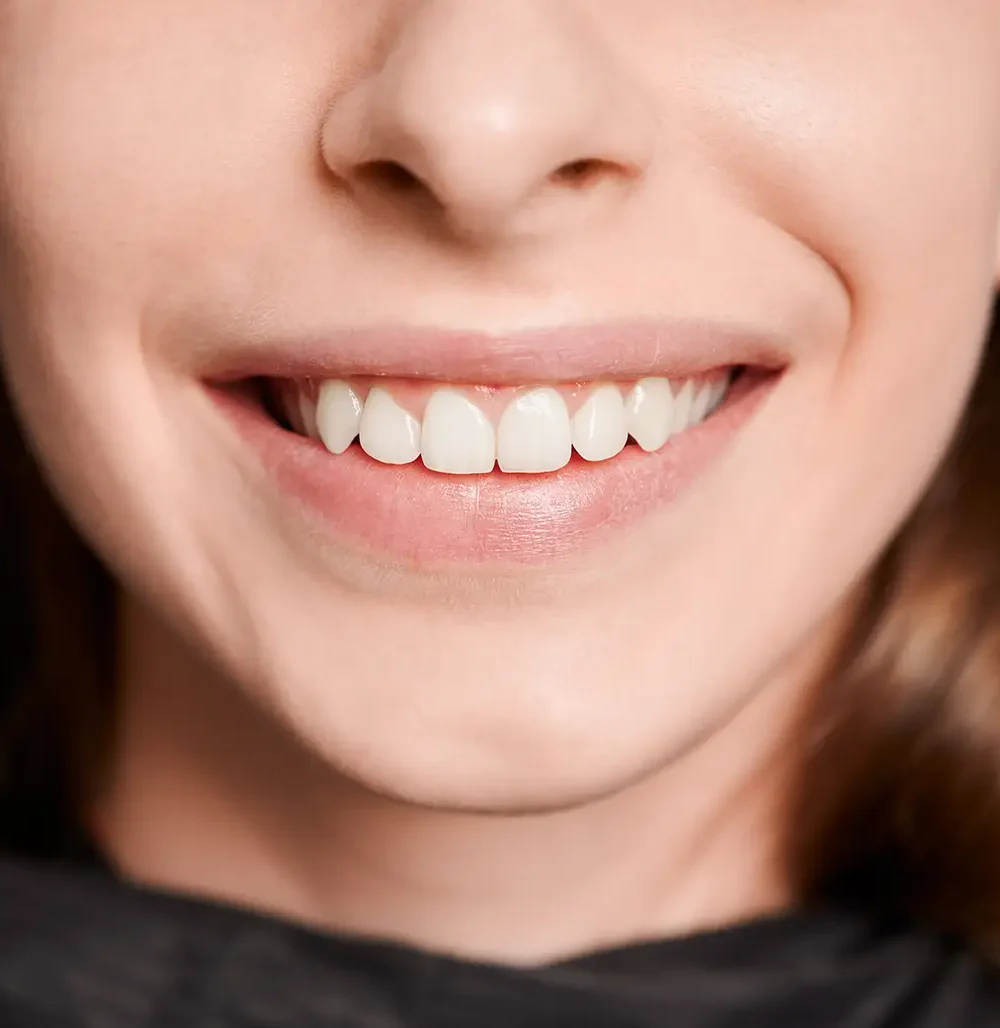 macro-photography-of-a-beautiful-female-smile-with-2026-01-07-01-00-07-utc